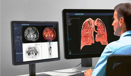 Health Care Agency gets $1m radiology information system