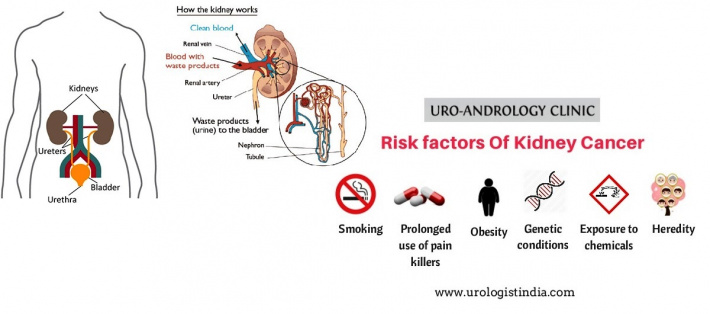 Kidney cancer: Q&A with Dr Todorovic