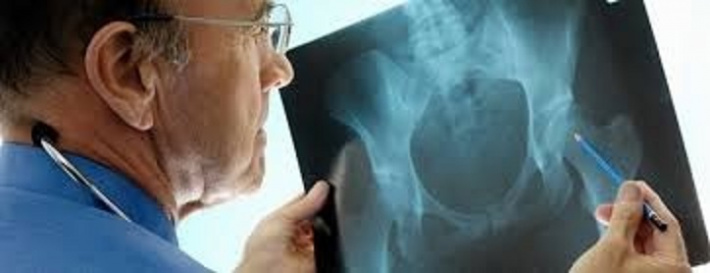 Osteoporosis: Q&A with Dr Todorovic